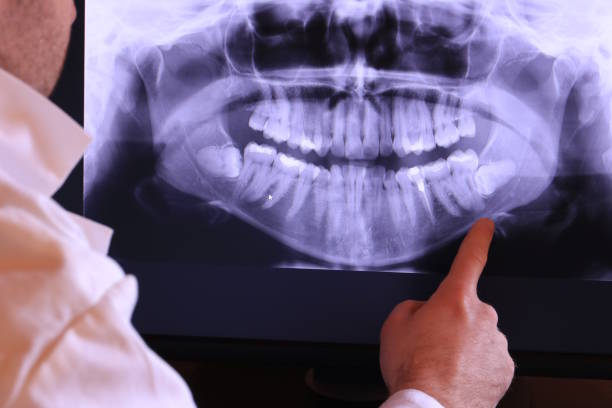 Best Dentist for Tooth Abscess  in Helmetta, NJ