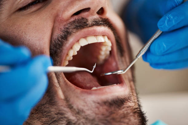 Best Broken Tooth Emergency  in Helmetta, NJ