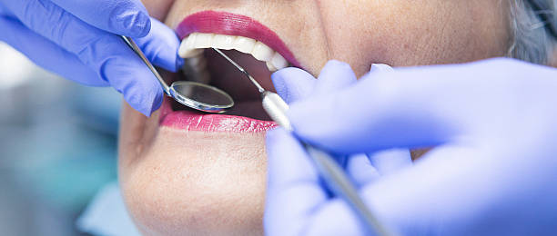 Best Emergency Dental Filling Replacement  in Helmetta, NJ